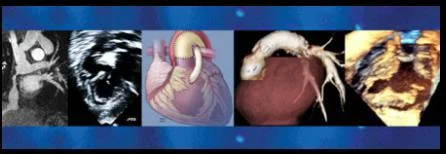 Echocardiography in Pediatric and Adult Congenital Heart Disease Symposium