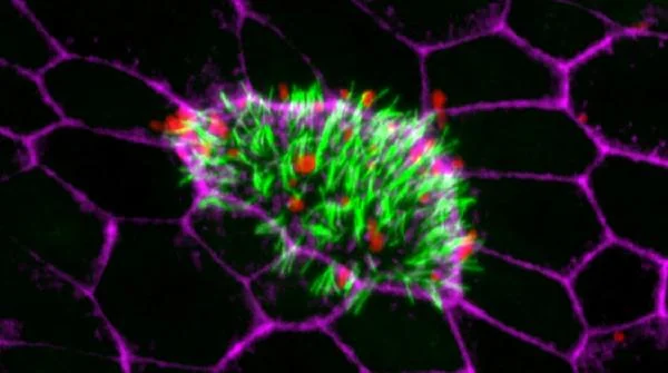 Symbiomes: systems biology of host-microbiome interactions