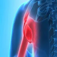 Mayo Clinic Comprehensive Shoulder and Elbow Course